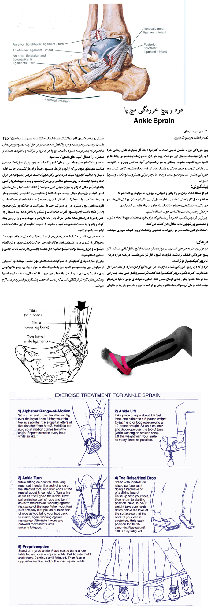 ankle-sprain