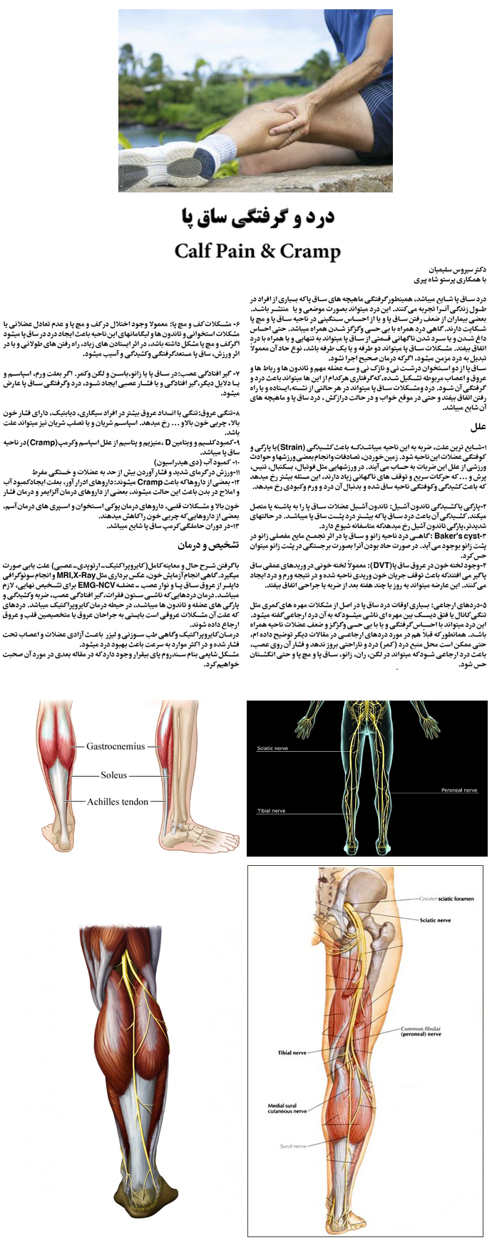 calf-pain