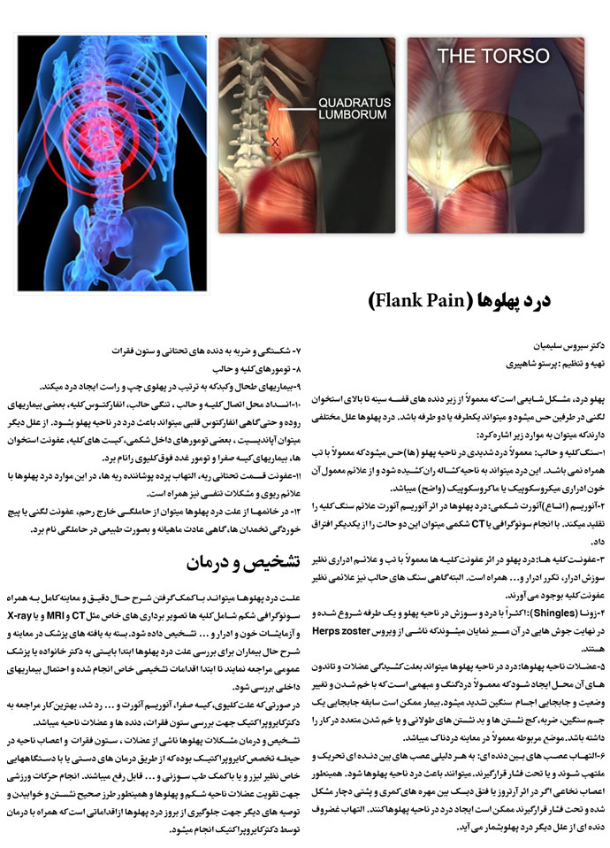 flank-pain-2