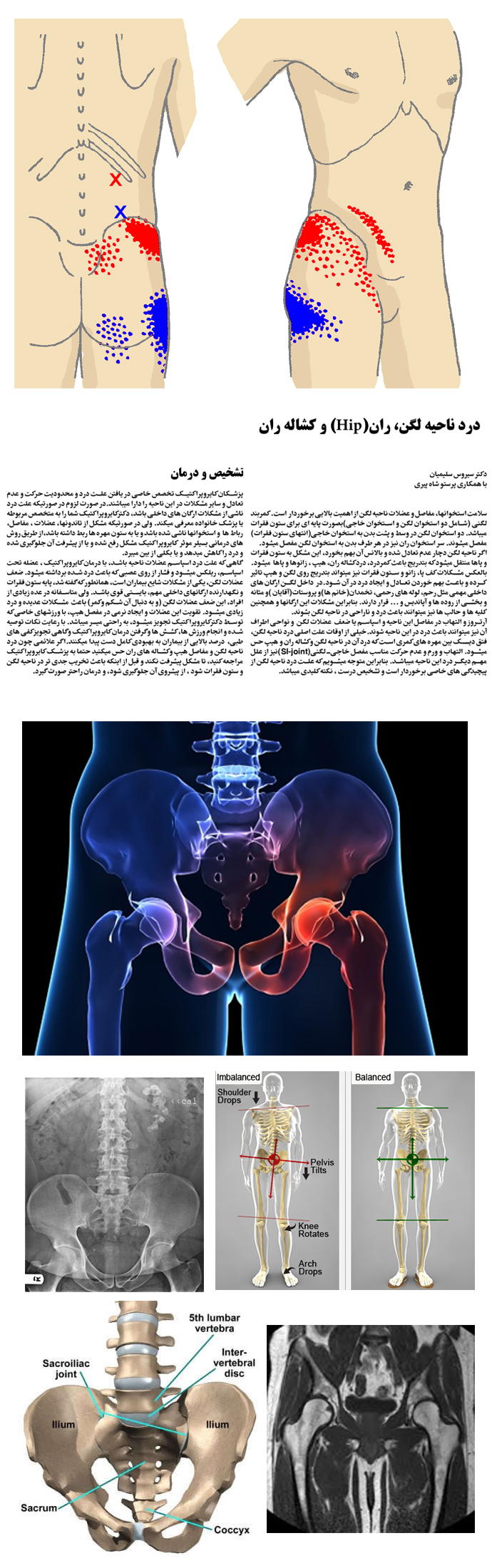 pelvic-hip