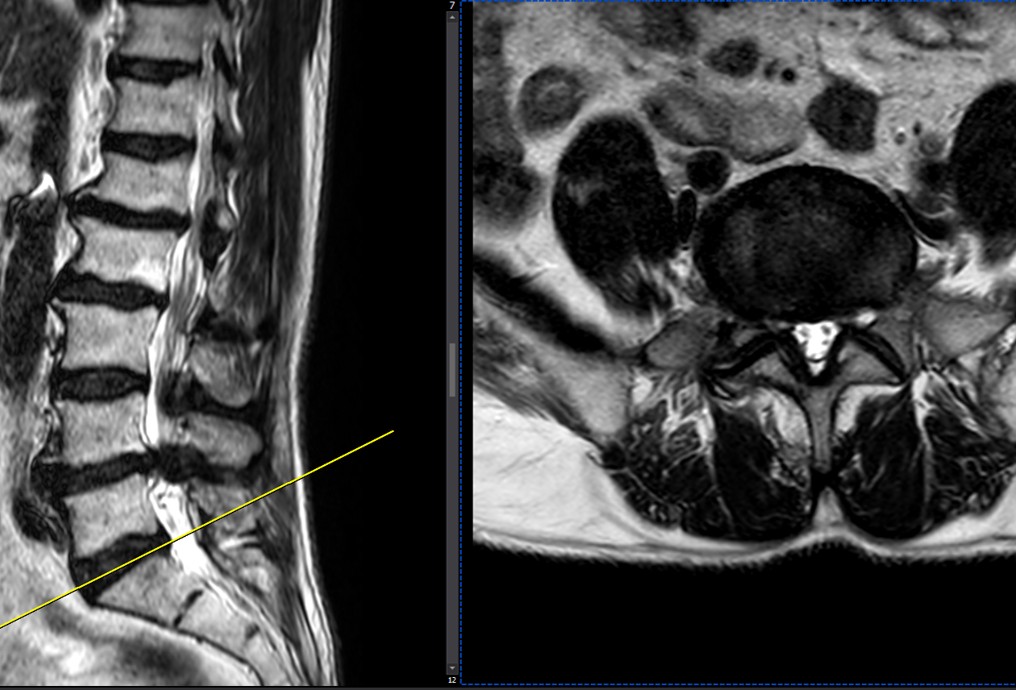 case29-01