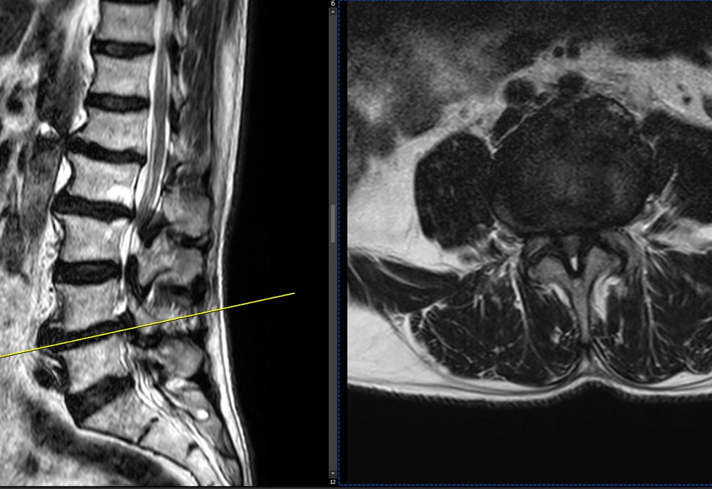 case29-02