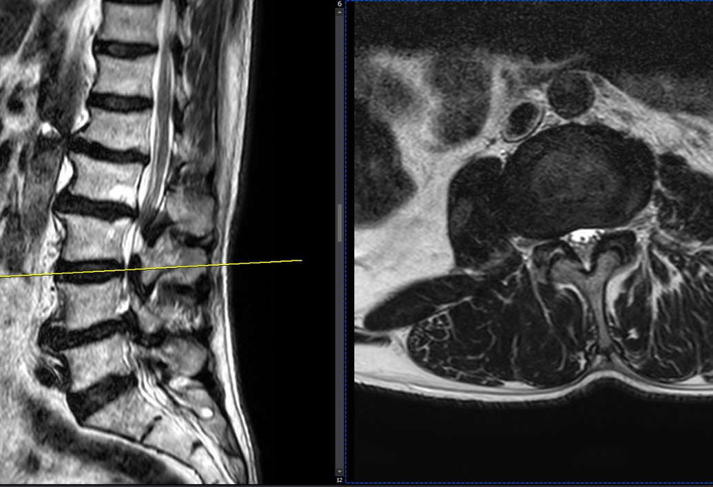 case29-03